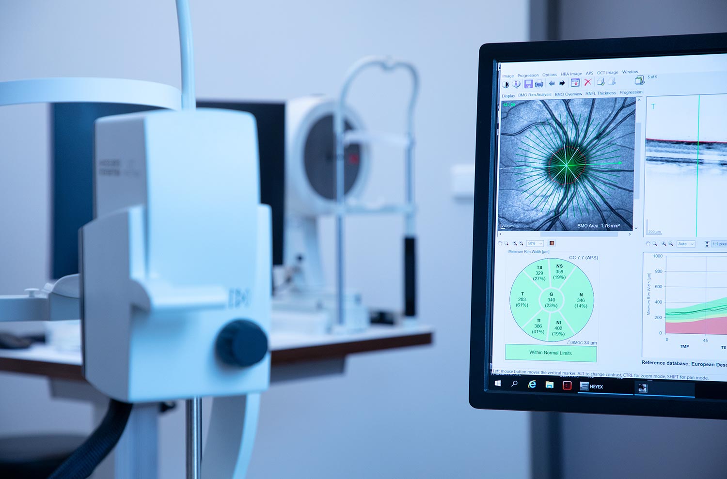 oct-analyse-am-monitor